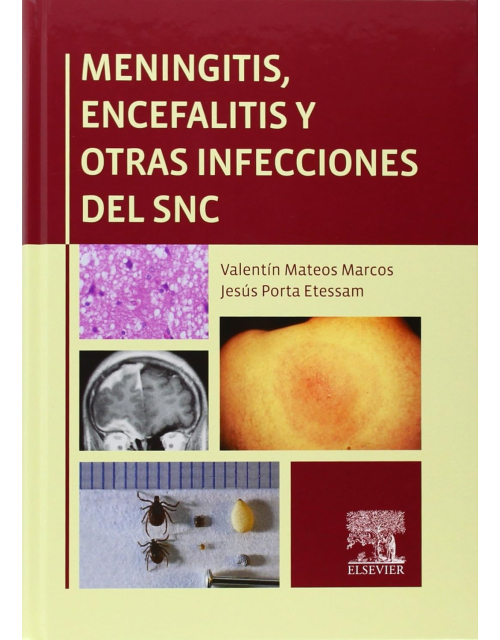 Meningitis, Encefalitis Y Otras Infecciones Del Snc