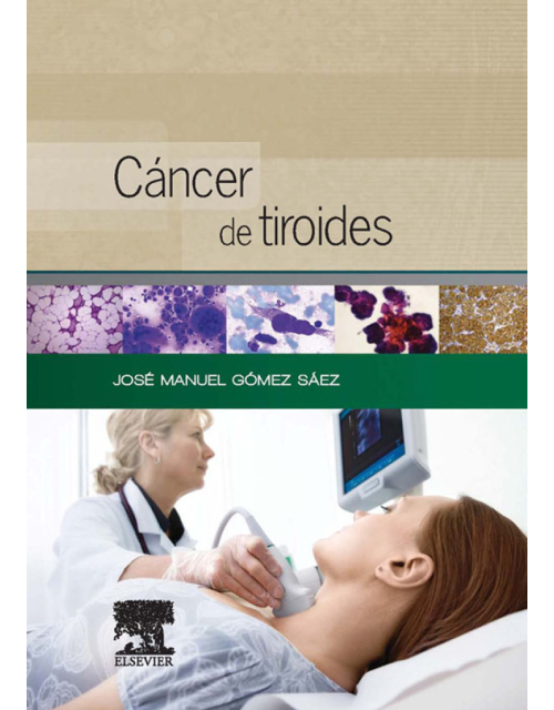 Cáncer De Tiroides