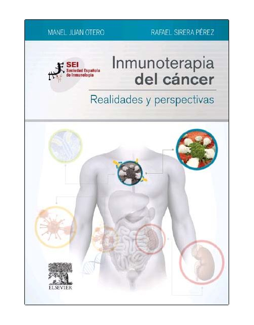 Inmunoterapia Del Cancer. Realidades Y Perspectivas
