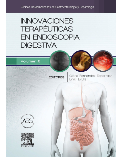 Innovaciones Terapéuticas En Endoscopia Digestiva (Clínicas Iberoamericanas De Gastroenterología Y Hepatología, Vol. 6)