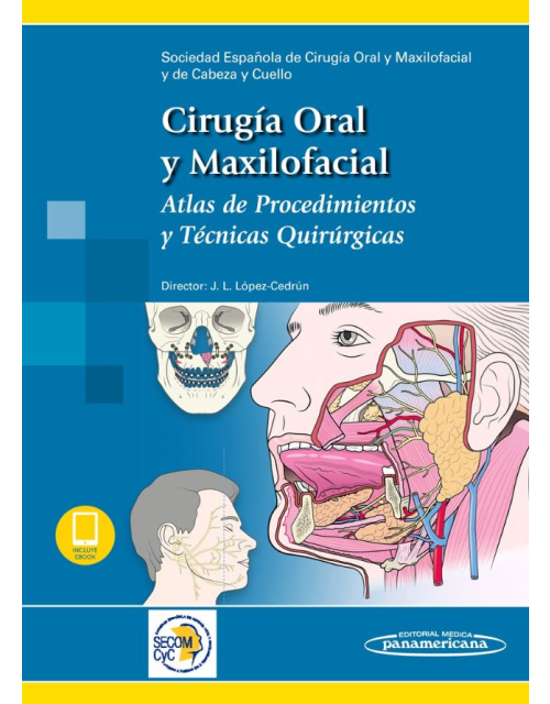 Cirugí­A Oral Y Maxilofacial (Incluye Version Digital)