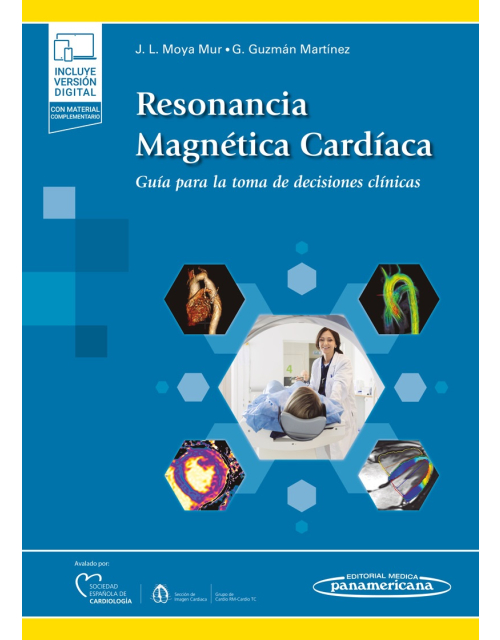Resonancia Magnética Cardíaca Guía Para La Toma De Decisiones Clínicas