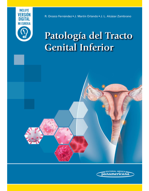 Patolog&iacute;a del Tracto Genital Inferior