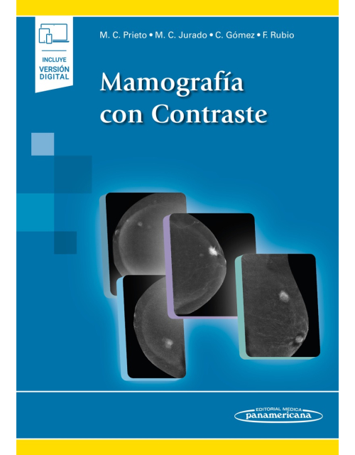 Mamografía Con Contraste Incluye Version Digital