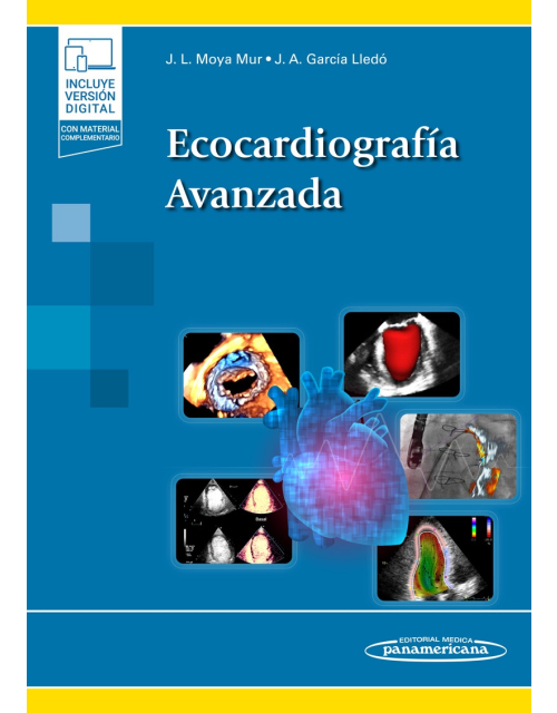 Ecocardiografía Avanzada
