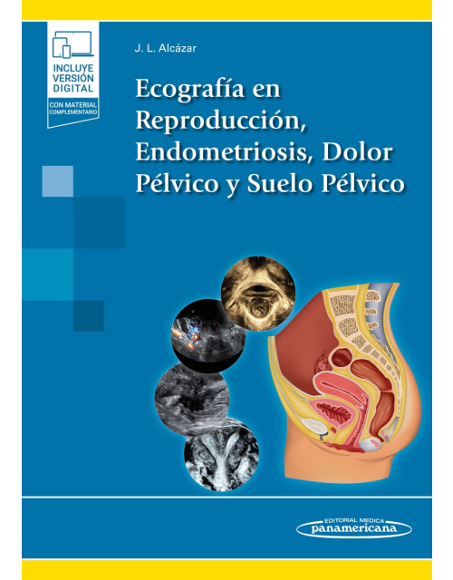 Ecografía En Reproducción Endometriosis Dolor Pélvico Y Suelo Pélvico
