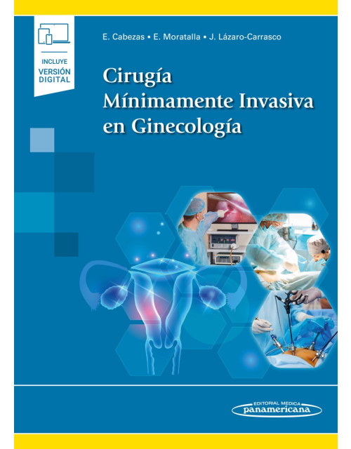 Cirugía Mínimamente Invasiva en Ginecología