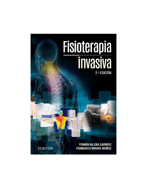 Fisioterapia Invasiva . + Acceso Online