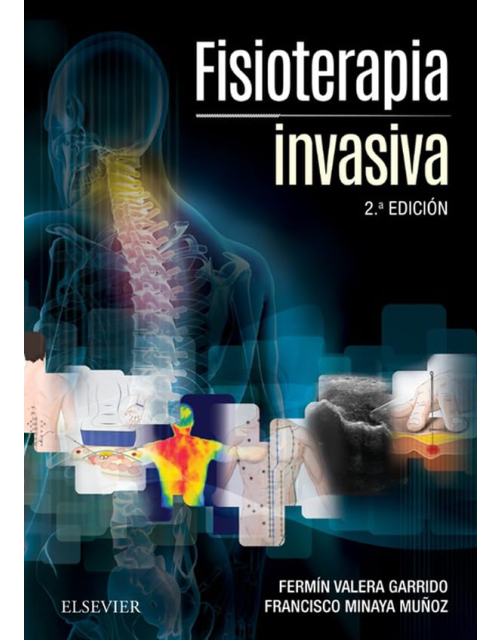 Fisioterapia Invasiva . + Acceso Online