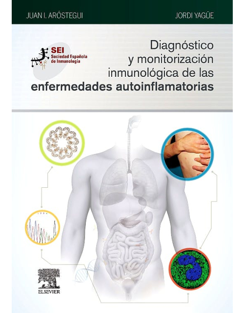 Diagnóstico Y Monitorización Inmunológica De Las Enfermedades Autoinflamatorias