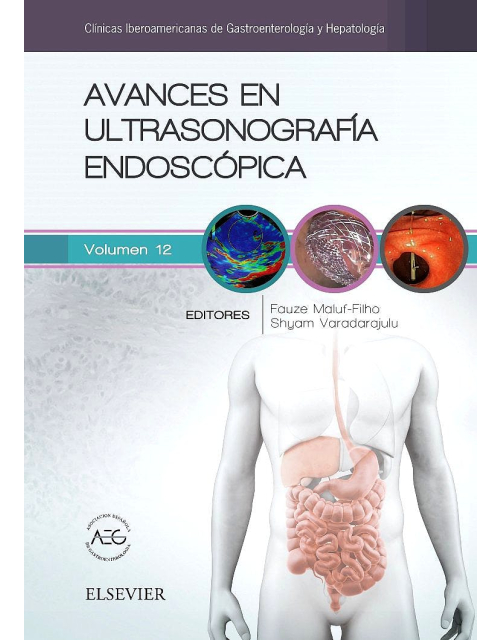Avances En Ultrasonografía Endoscópica (Clínicas Iberoamericanas De Gastroenterología Y Hepatología, Vol. 12)