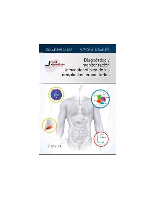 Diagnóstico Y Monitorización Inmunofenotípica De Las Neoplasias Leucocitarias