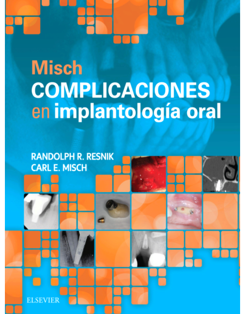Misch Complicaciones En Implantología Oral