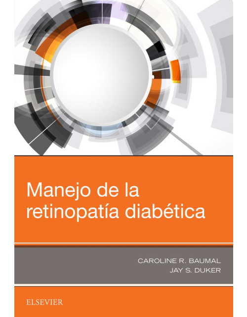Manejo De La Retinopatía Diabética