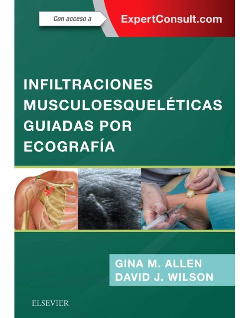 Infiltraciones Musculoesqueléticas Guiadas por Ecografía