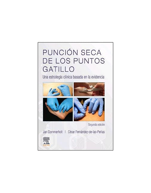 Punción Seca De Los Puntos Gatillo .