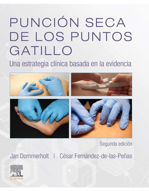 Punción Seca De Los Puntos Gatillo .