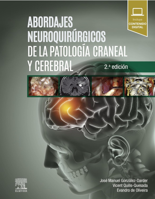Abordajes Neuroquirúrgicos De La Patología Craneal Y Cerebral + Acceso Online