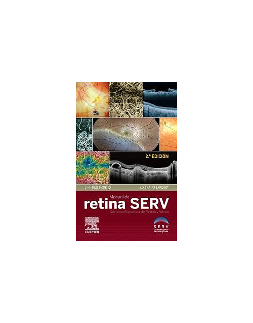 Manual De Retina Serv .