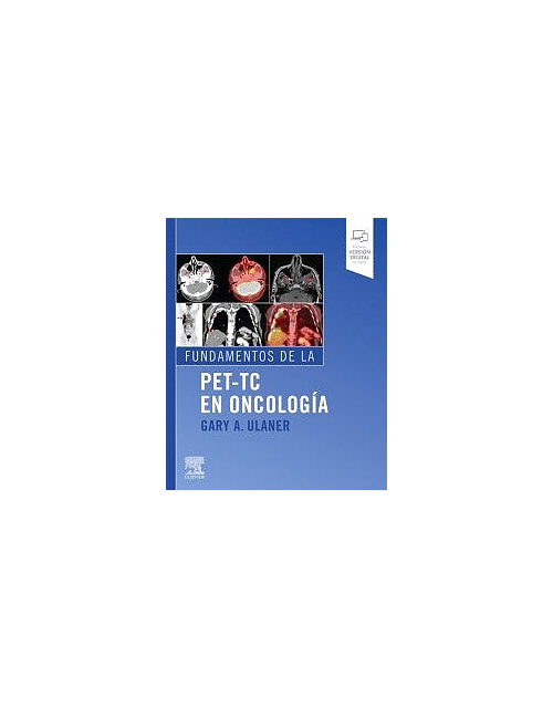 Fundamentos De La Pet-Tc En Oncología