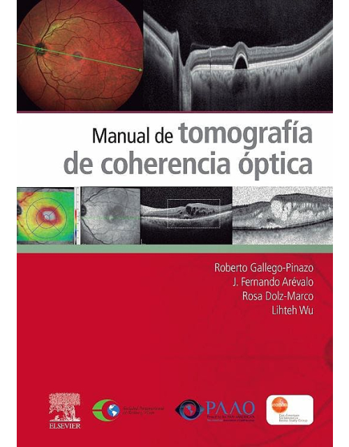 Manual De Tomografía De Coherencia Óptica