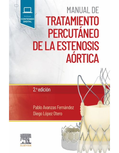 Manual De Tratamiento Percutáneo De La Estenosis Aórtica