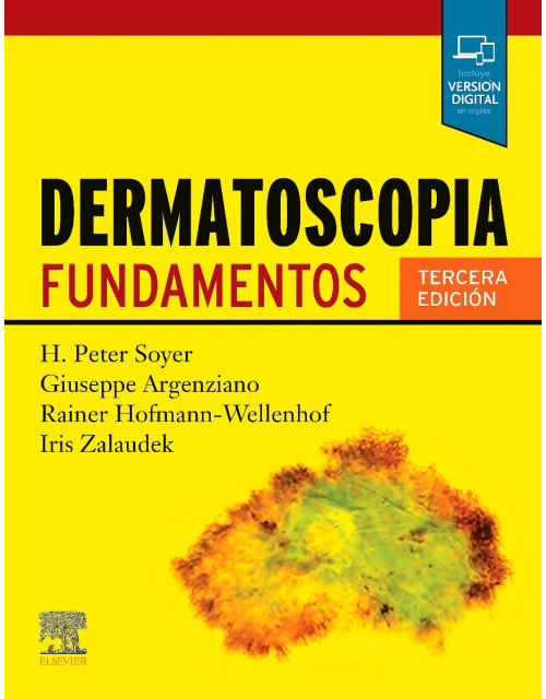 Dermatoscopia