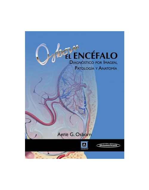 El Encéfalo Diagnóstico Por Imagen Patología Y Anatomía