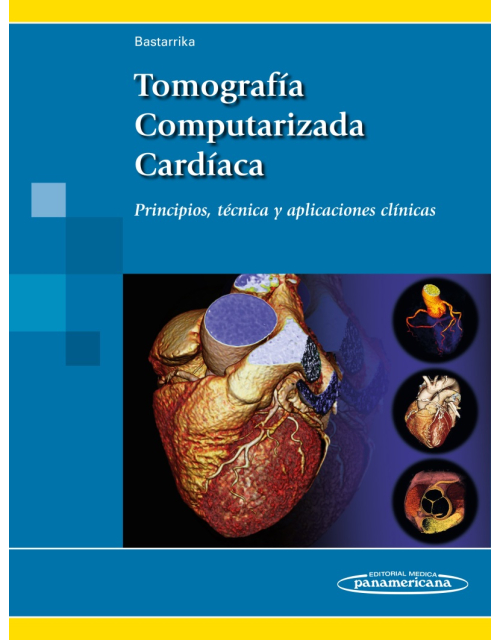 Tomografía Computarizada Cardíaca