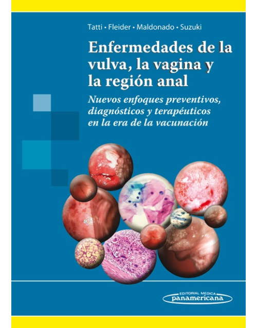 Enfermedades De La Vulva La Vagina Y La Región Anal