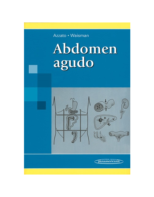 Abdomen Agudo