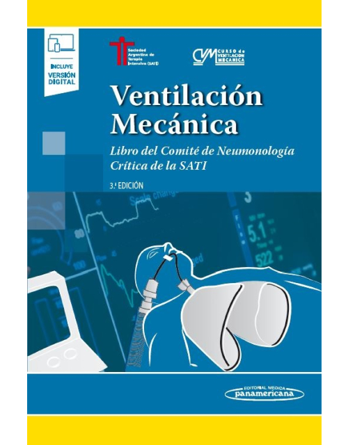 Ventilación Mecánica