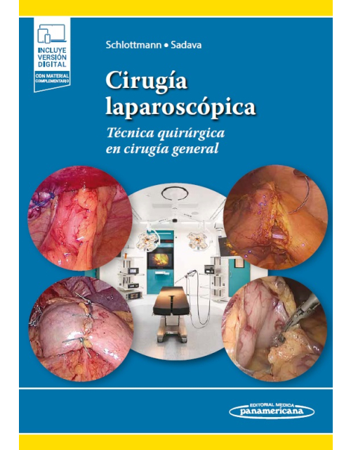 Cirugía Laparoscópica. Técnica Quirúrgica en Cirugía General