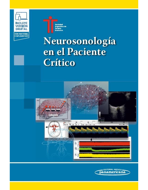Neurosonología en el Paciente Crítico