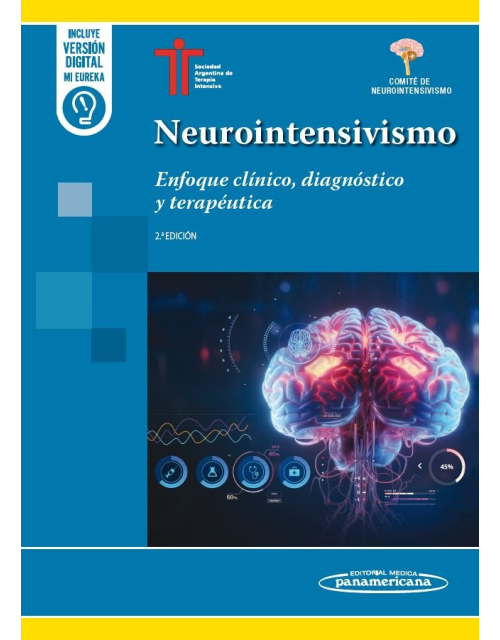 Neurointensivismo. Enfoque Clínico, Diagnóstico y Terapéutica