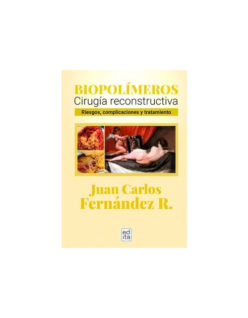 Biopolímeros. Cirugía reconstructiva