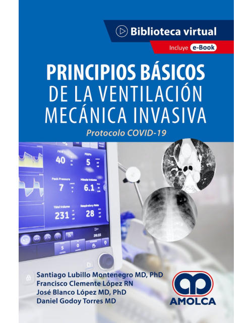 Principios Básicos de la Ventilación Mecánica Invasiva.