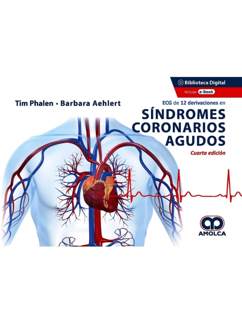 ECG de 12 Derivaciones en Síndromes Coronarios Agudos