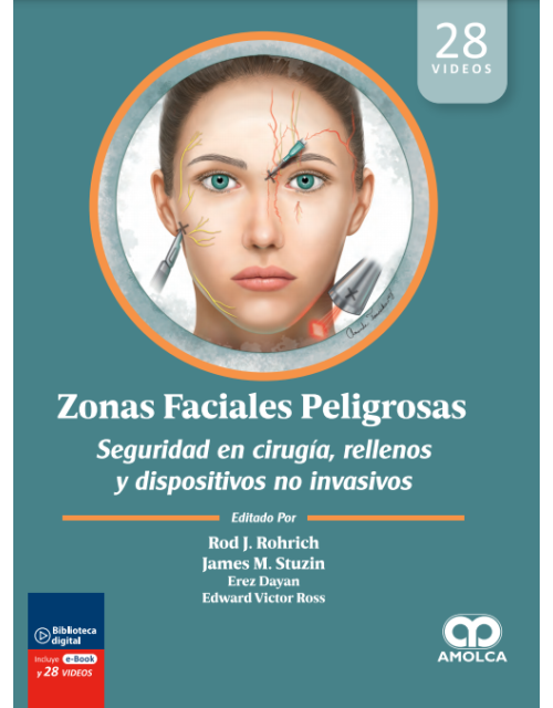 Zonas Faciales Peligrosas.