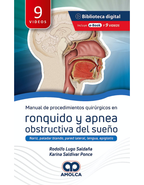 Manual de Procedimientos Quirúrgicos en Ronquido y Apnea Obstructiva del Sueño