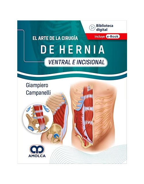 El Arte de la Cirugía de Hernia. Ventral e Incisional