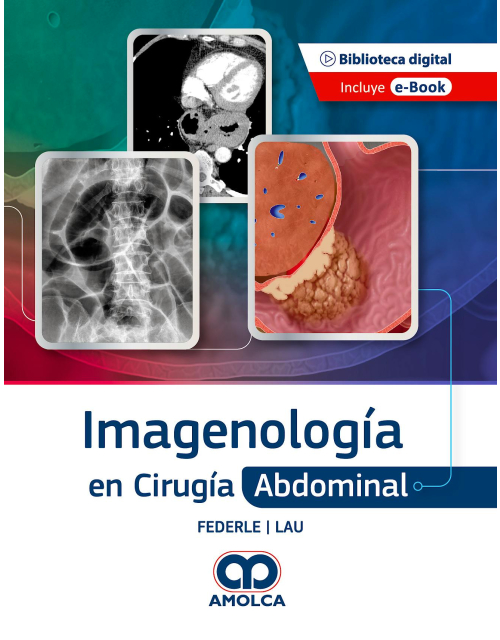 Imagenología en Cirugía Abdominal