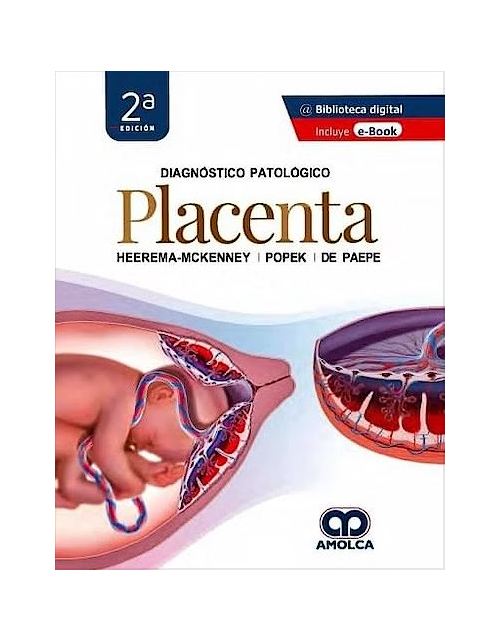 Diagnóstico Patológico. Placenta
