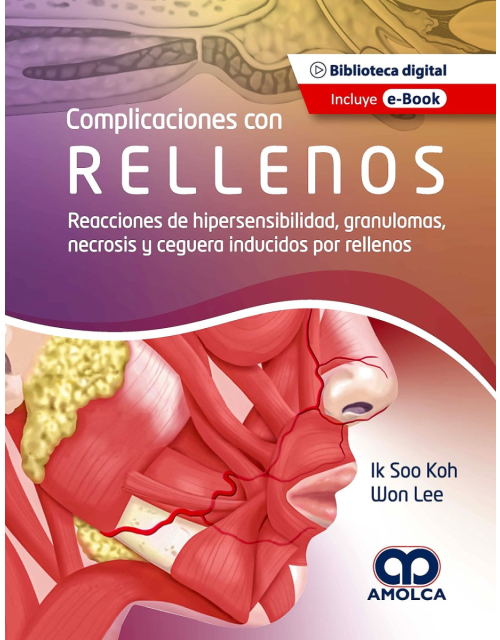 Complicaciones con Rellenos