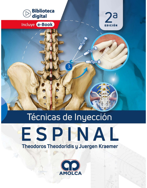 Técnicas de Inyección Espinal
