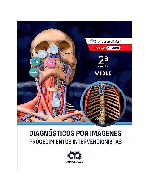 Diagnósticos por Imágenes. Procedimientos Intervencionistas