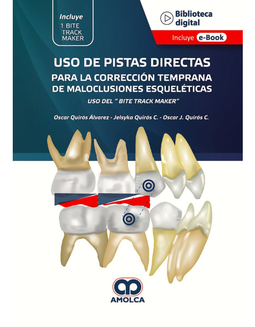 Uso de Pistas Directas para la Corrección Temprana de Maloclusiones Esqueléticas