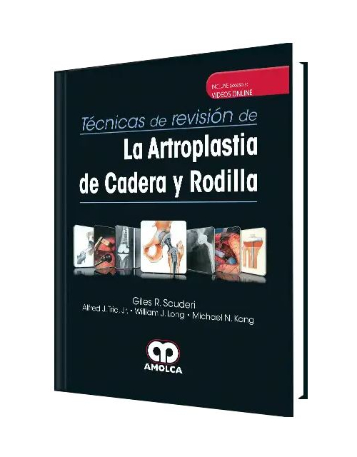 Técnicas de Revisión de la Artroplastia de Cadera y Rodilla