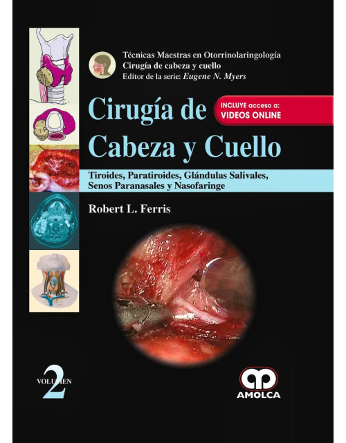 Cirugía de Cabeza y Cuello