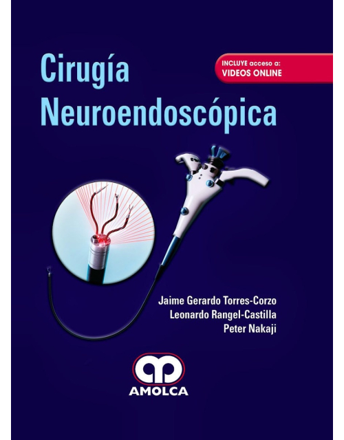 Cirugía Neuroendoscópica